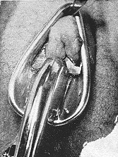 FemCirc4.gif (47 KB)