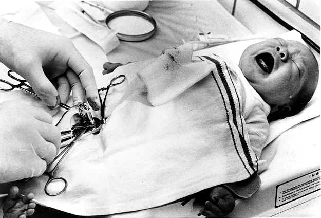 Hospital Circumcision.jpg (28 KB)