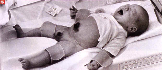 Hospital Circumcision5.jpg (21 KB)