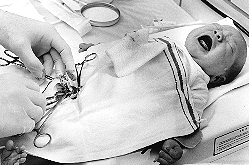 Male Circumcision.gif (46 KB)